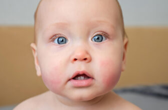 Allergies chez les enfants de moins d'un an